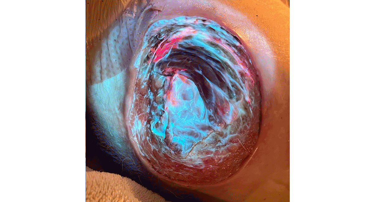 REVEAL otofloresans